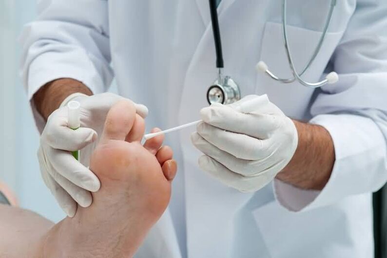 Εάν έχετε συμπτώματα μύκητα των νυχιών των ποδιών, θα πρέπει να συμβουλευτείτε έναν δερματολόγο ή μυκητολόγο. 